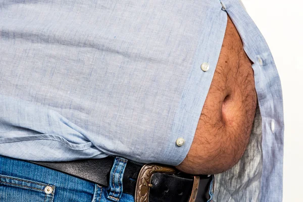 Man with overweight — Stock Photo, Image