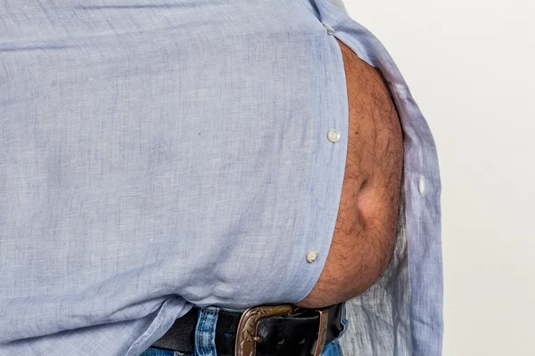 Man with overweight — Stock Photo, Image