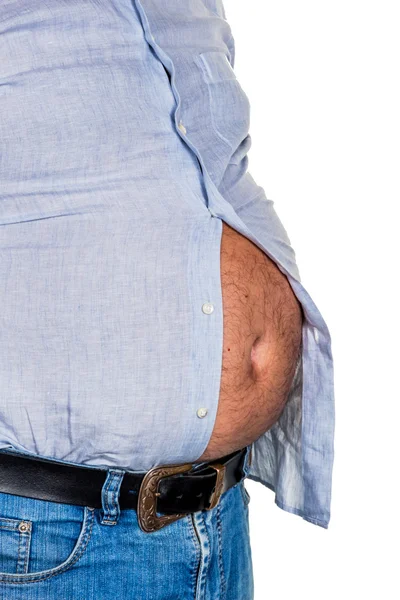 Man with overweight — Stock Photo, Image