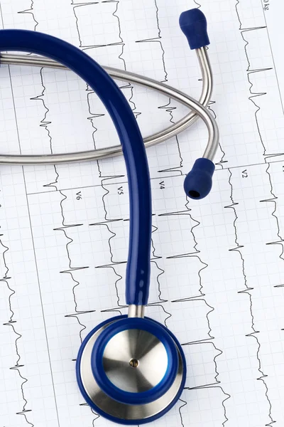 Stethoscope and electrocardiogram — Stock Photo, Image