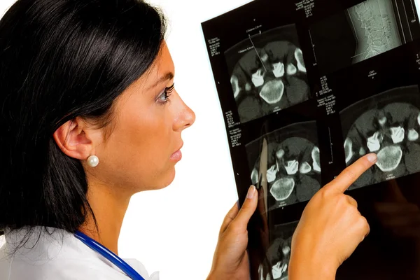Женщина врач с рентгеновским снимком — стоковое фото