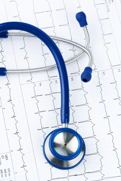 Stethoscope and electrocardiogram — Stock Photo, Image