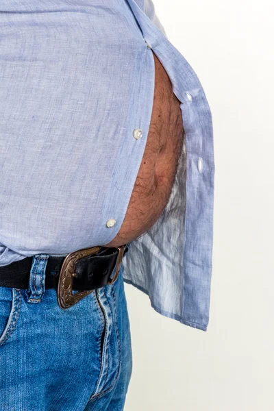 Homem com excesso de peso — Fotografia de Stock