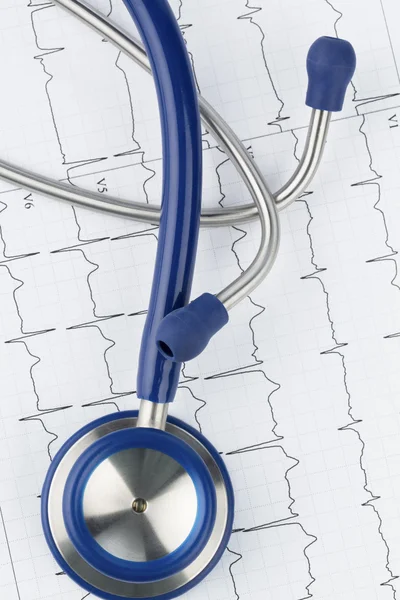 Stethoscope and electrocardiogram — Stock Photo, Image