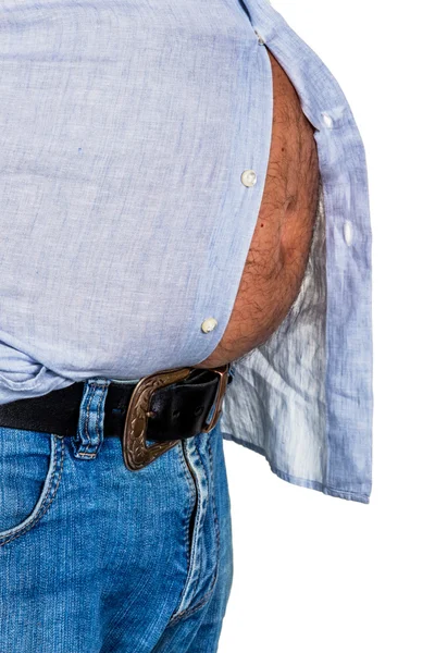 Man with overweight — Stock Photo, Image