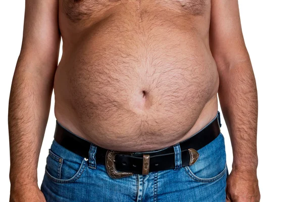 Man with overweight — Stock Photo, Image