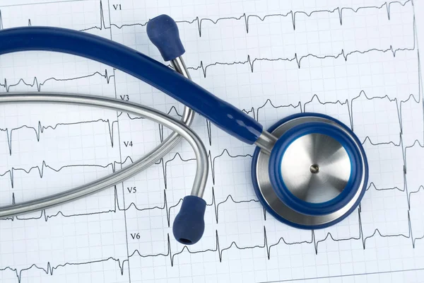 Estetoscopio y electrocardiograma — Foto de Stock