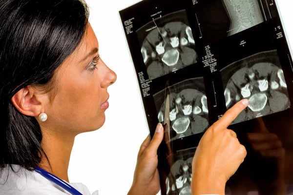 Médico mulher com imagem de raio-x — Fotografia de Stock