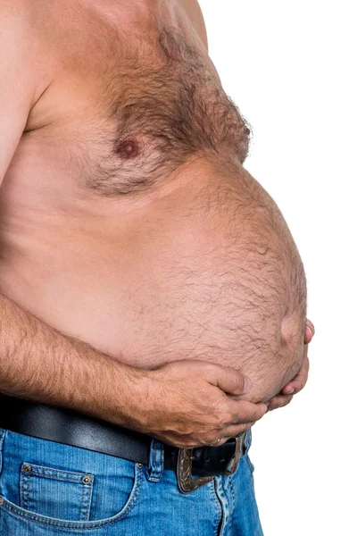 Man with overweight — Stock Photo, Image