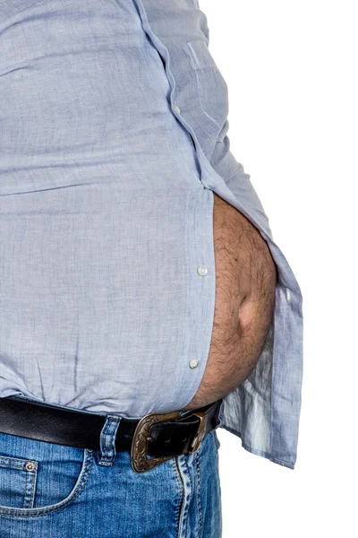 Man with overweight — Stock Photo, Image