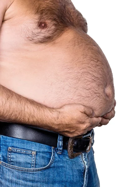 Man with overweight — Stock Photo, Image