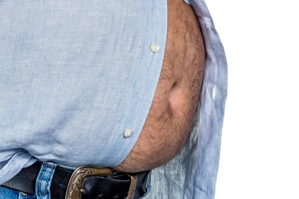 Man with overweight — Stock Photo, Image