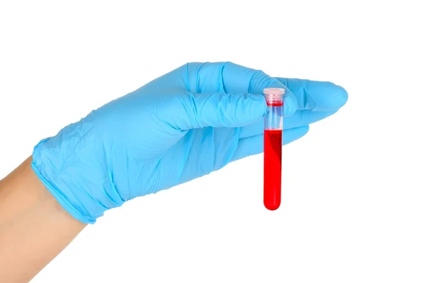 Hand with test tube — Stock Photo, Image