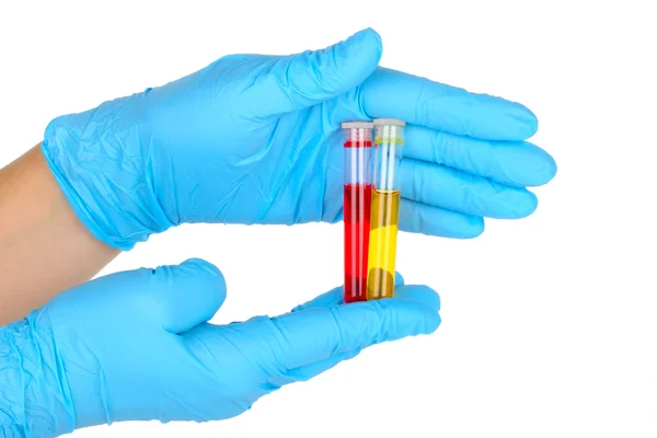 Hands with test tubes — Stock Photo, Image