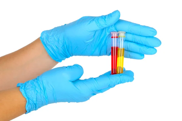 Hands with test tubes — Stock Photo, Image