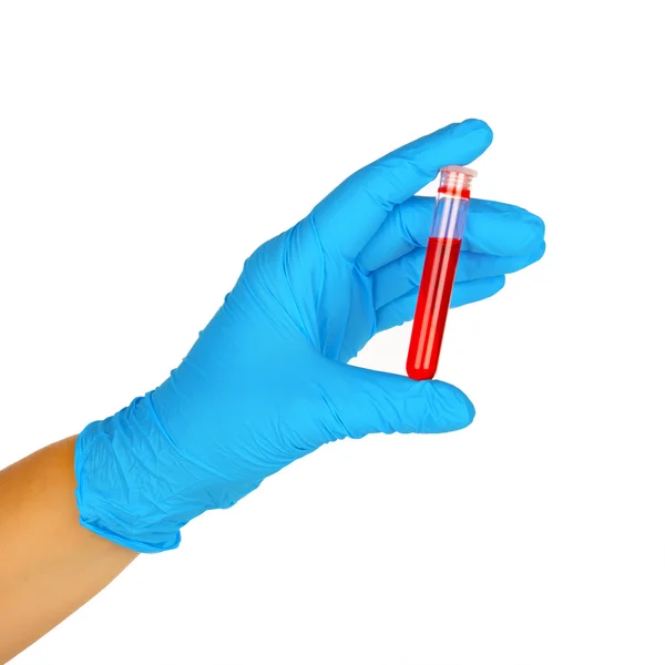 Hand with test tube — Stock Photo, Image