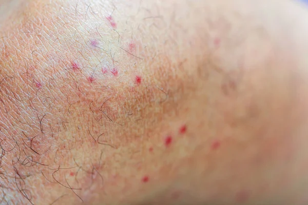 Close Nyamuk Mengisap Darah — Stok Foto