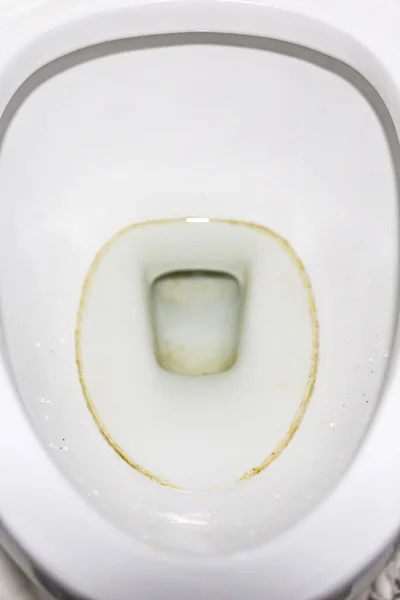Brudna Muszla Klozetowa Toalecie — Zdjęcie stockowe