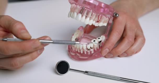 Οδοντίατρος Δείχνει Οδοντιατρικά Προβλήματα Στο Σαγόνι Μοντέλο Τερηδόνα Στοματική Υγιεινή — Αρχείο Βίντεο