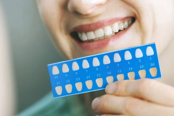 Mujer Que Utiliza Los Dientes Blanqueamiento Guía Sombra Delante Del — Foto de Stock