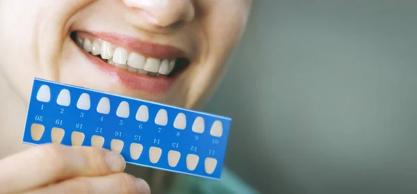Kadın Diş Beyazlatma Kılavuzu Kullanıyor Diş Beyazlatma Afiş Kopyalama Alanı — Stok fotoğraf