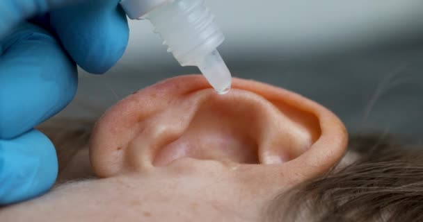 Arzt Tropft Ohrtropfen Ins Ohr Des Patienten Ohrenschmerzbehandlung Und Verstopfte — Stockvideo