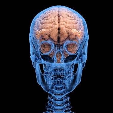 X-ray insan kafatası ve siyah arka planda izole edilmiş beyin. 