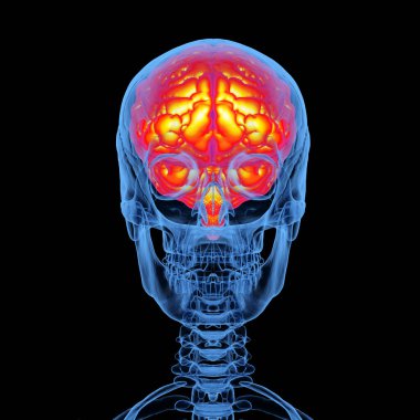 X-ray insan kafatası ve siyah arka planda izole edilmiş beyin. 