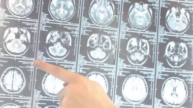 X-ışını arıyorsunuz doktor parmak