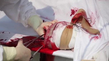 Hastanede ameliyat yapma eller closeup