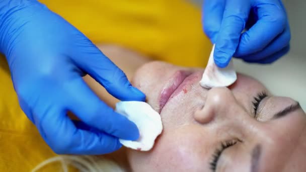 Close-up van de handen van de cosmetoloog die botox injecteert. Ze houdt de spuit vast. Vrouw ontvangt procedure met plezier — Stockvideo