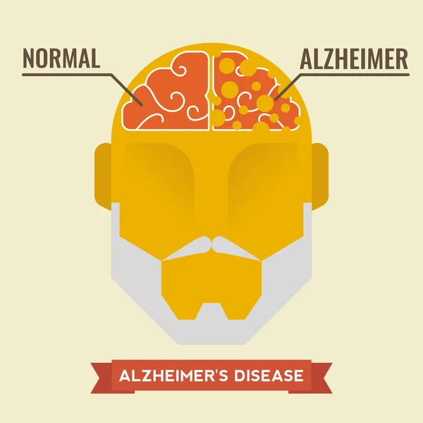 Alzheimer — Stock Vector