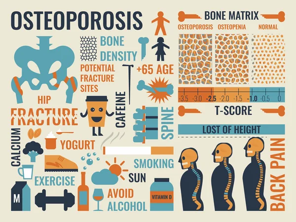 Osteoporose — Stockvektor