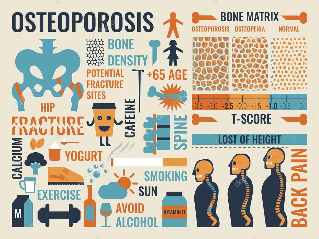 Osteoporosis Stock Vector Image by ©nongpimmy 81741298