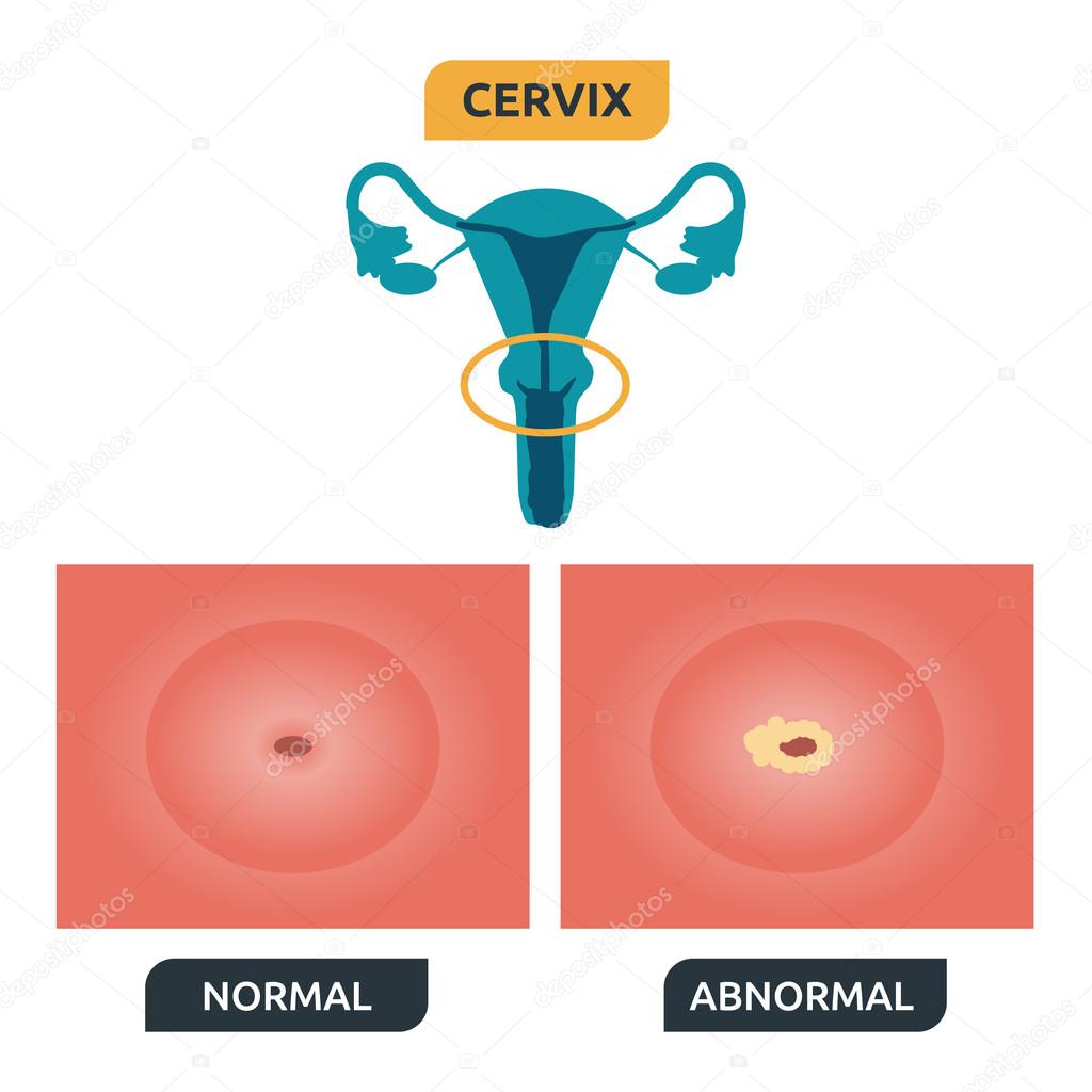 Cervix