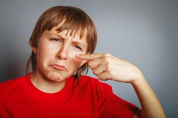 Европейский мальчик 10 лет с прыщом на носу, расстроенный из-за — стоковое фото