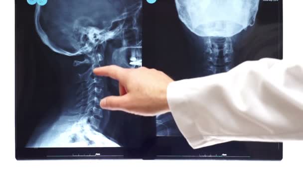 Dokter punten op nek Xray — Stockvideo