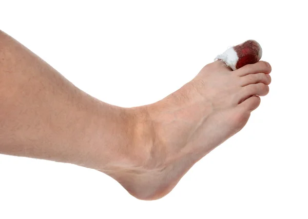 Arzthände behandeln Männerbein mit blutbandagiertem Pa — Stockfoto