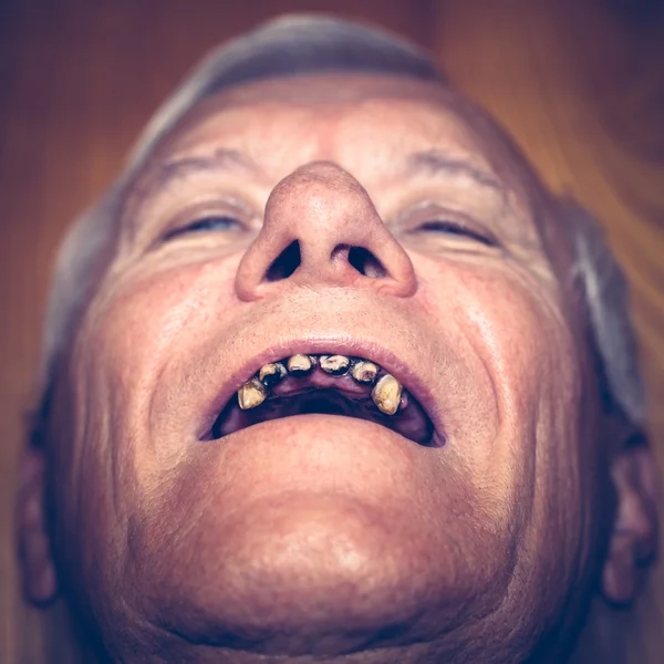 Viejo con dientes feos — Foto de Stock