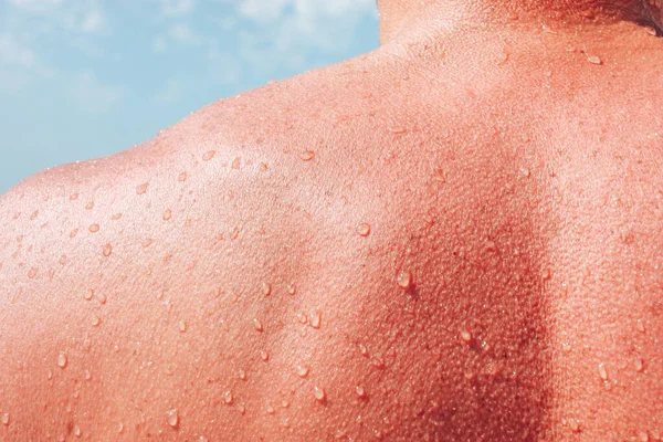 男性の肩に水を垂らす白人の皮膚に 海とビーチを背景に男の体に濡れた液滴 — ストック写真