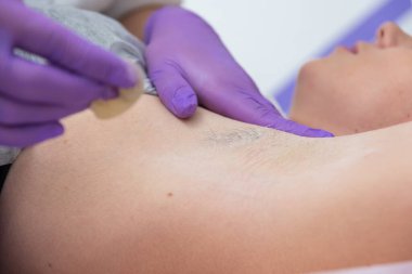 Şekerleme tüy temizleme konsepti. Spa salonunda şeker ezmeli, beyaz arka planda, koltuk altı kizinin işlem depilasyonu.