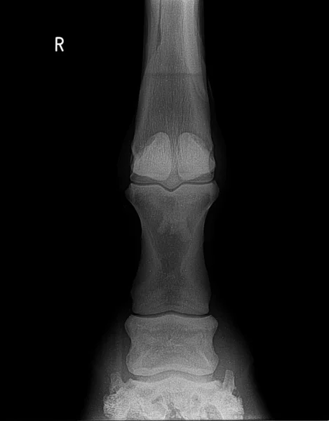 Hores voorzijde rechterbeen xray foto. — Stockfoto