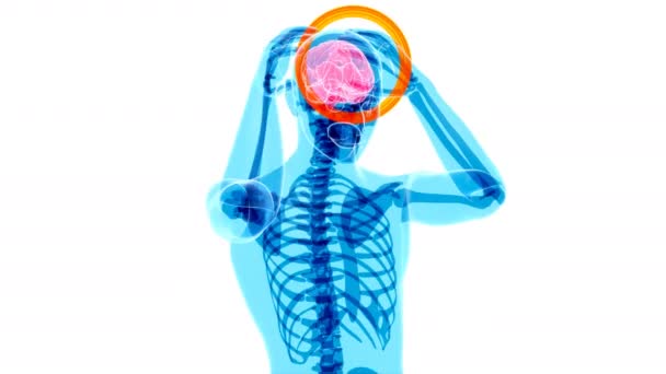 Huvudvärk Människa Och Hjärna Xray Mänsklig Anatomi Animering — Stockvideo