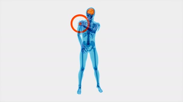 Shoulder Pain Animation — Stock Video