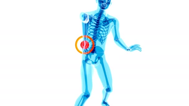 Man Suffering Severe Back Pain — Stock Video