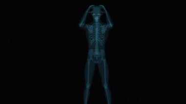 Baş ağrısı, insan ve beyin röntgeni, insan anatomisi, 3 boyutlu animasyon 