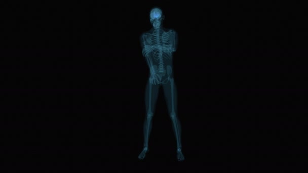 Πόνος Στον Αγκώνα Xray Animation — Αρχείο Βίντεο