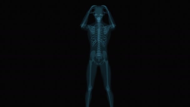 Sakit Kepala Ray Otak Anatomi Manusia Animasi — Stok Video