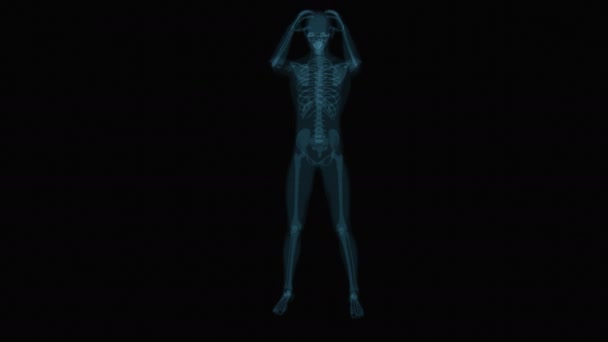 Cefalea Rayos Humanos Cerebrales Anatomía Humana Animación — Vídeo de stock