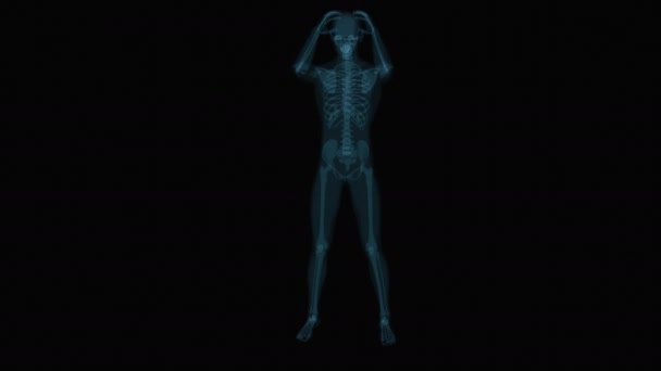 Huvudvärk Människa Och Hjärna Xray Mänsklig Anatomi Animering — Stockvideo